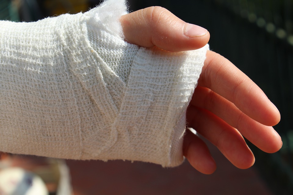 A broken hand in a cast.