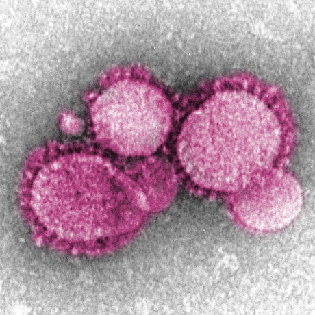 A picture of a microscopic look at the novel coronavirus.