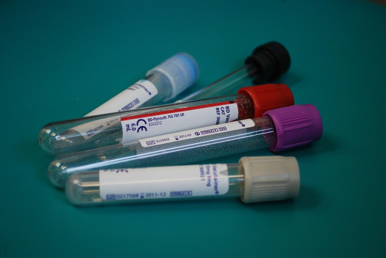 A photo of lab test vials